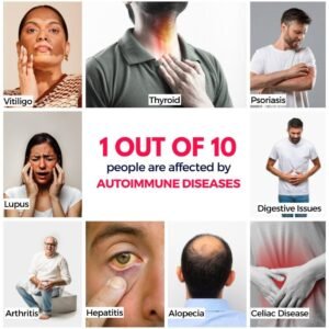 Cure Autoimmune Diseases Naturally