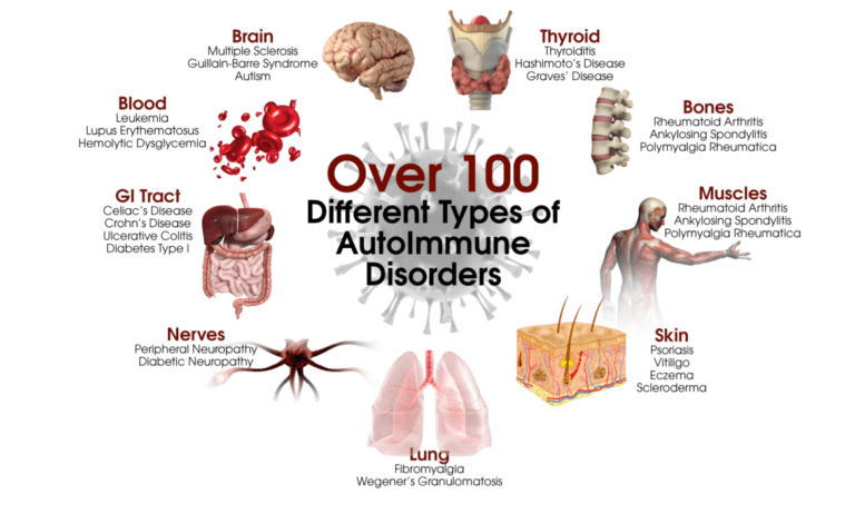 Healing Autoimmune Diseases naturally.jpeg