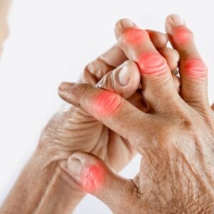 Heal Arthritis & Joint Pain Naturally (In Hindi)