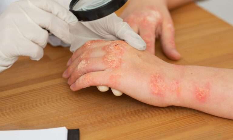 Heal Skin Diseases Naturally.jpeg