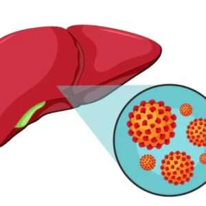 Heal Hepatitis Naturally Webinar